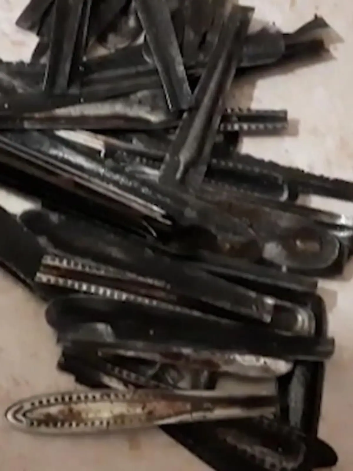 Nach der Operation hält der Arzt ein klimperndes Säckchen voller Löffel-Stiele aus Metall hoch. Insgesamt 63 Stück hatte ein Mann aus Uttar Pradesh in Indien in seinem Magen. Laut eigener Aussage habe er sie selbstständig verschluckt – warum, ist dabei unklar.