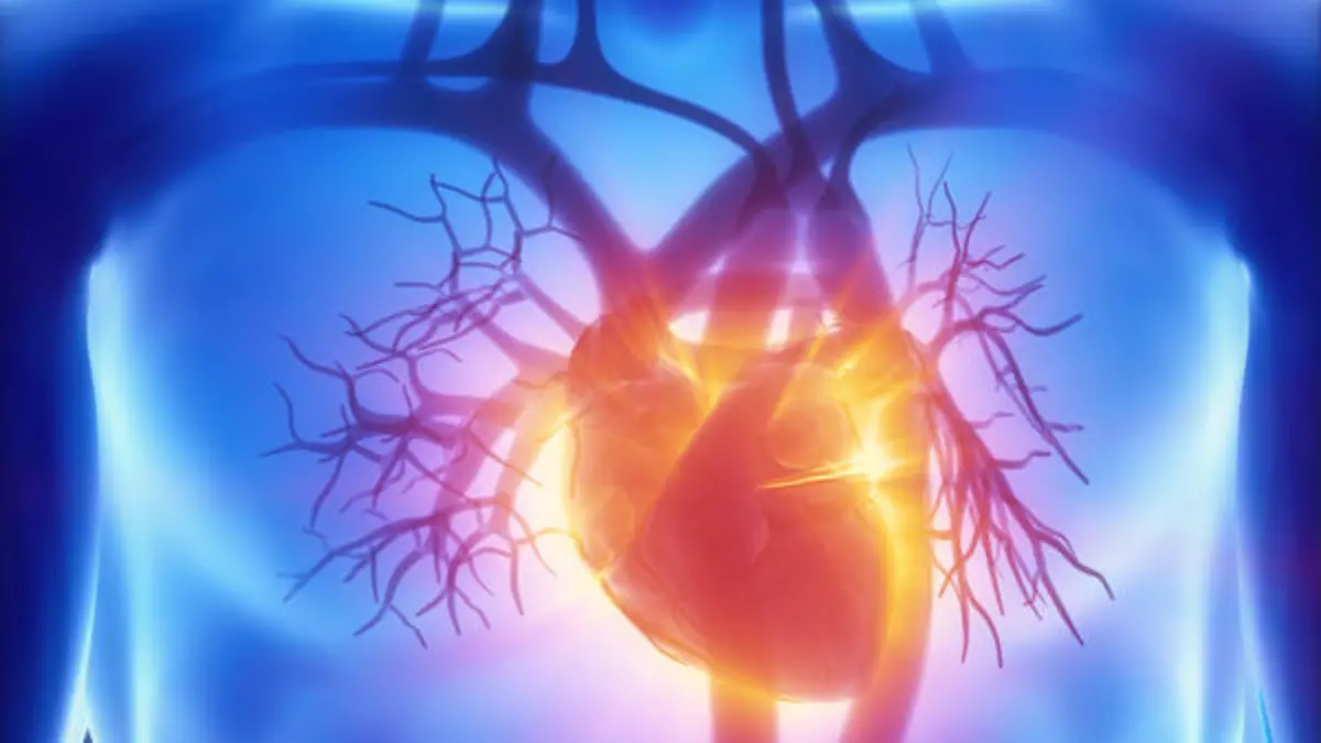 X-ray cardiovascular system Herzinfarkt Herz Herz-Kreislauf
