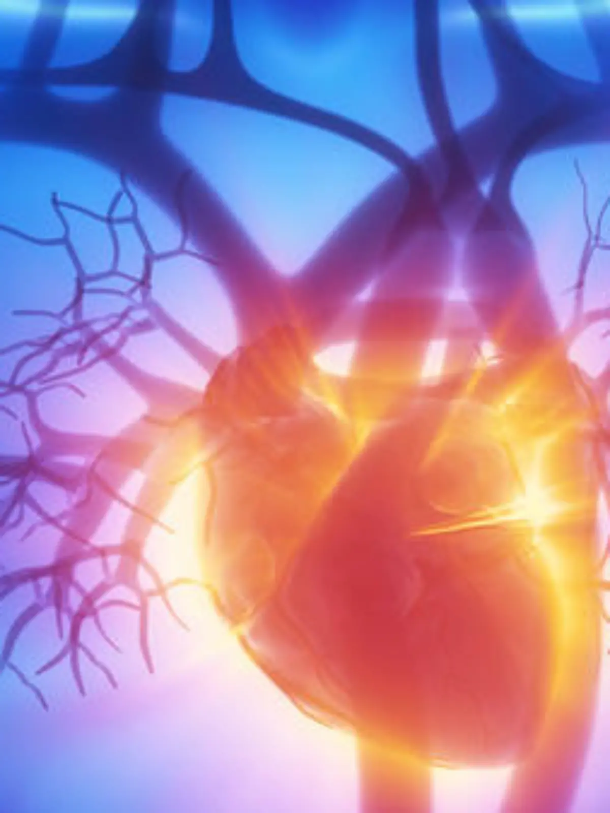 X-ray cardiovascular system Herzinfarkt Herz Herz-Kreislauf