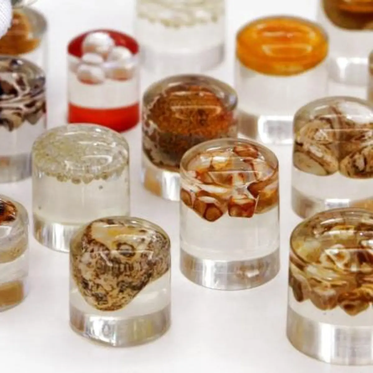 Gallensteine (Cholelithiasis) Logo von Gallensteine (Cholelithiasis)