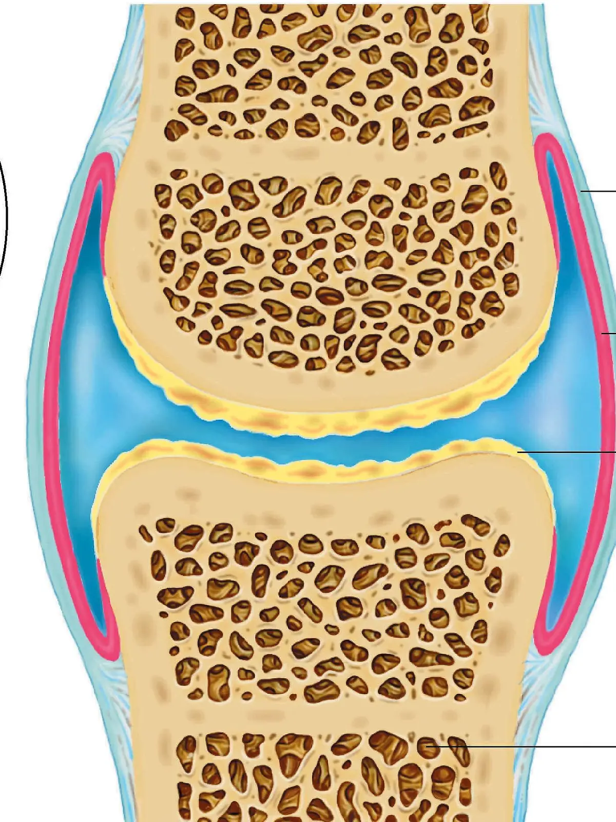 Die Illustration zeigt eine arthritisch erkranktes Gelenk.