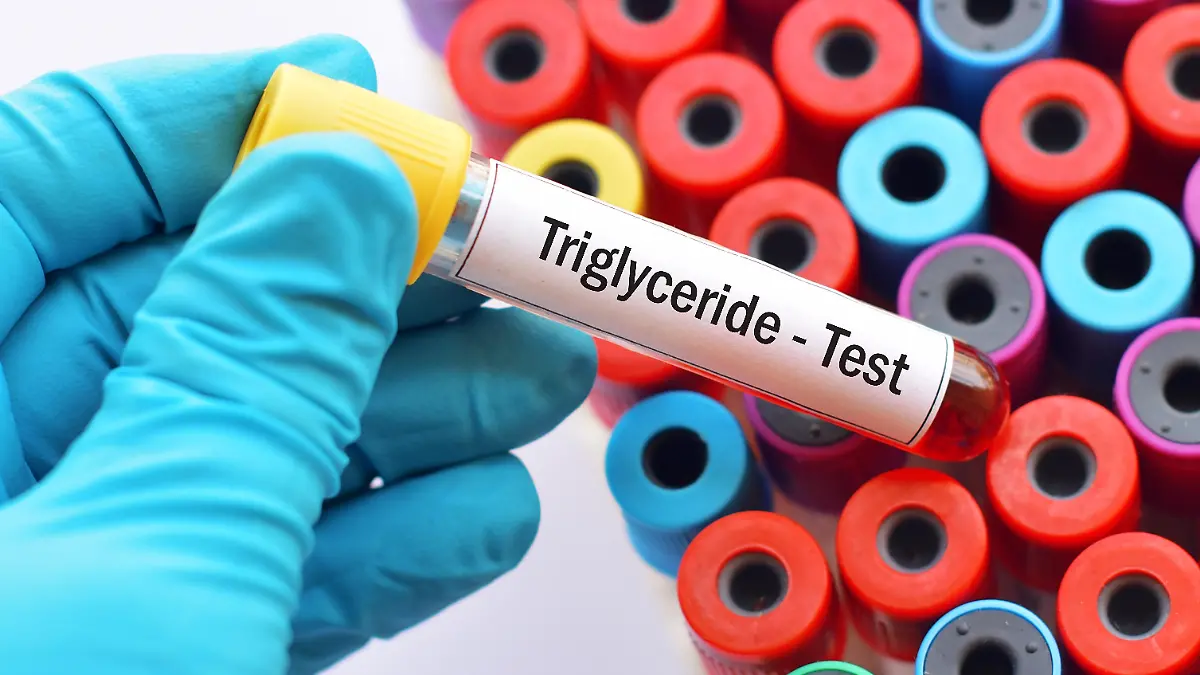 Gesundheitslexikon: Triglyceride