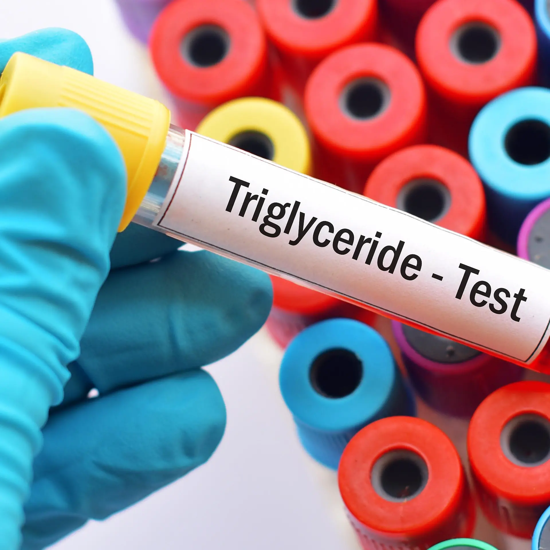 Triglyceride Logo von Triglyceride