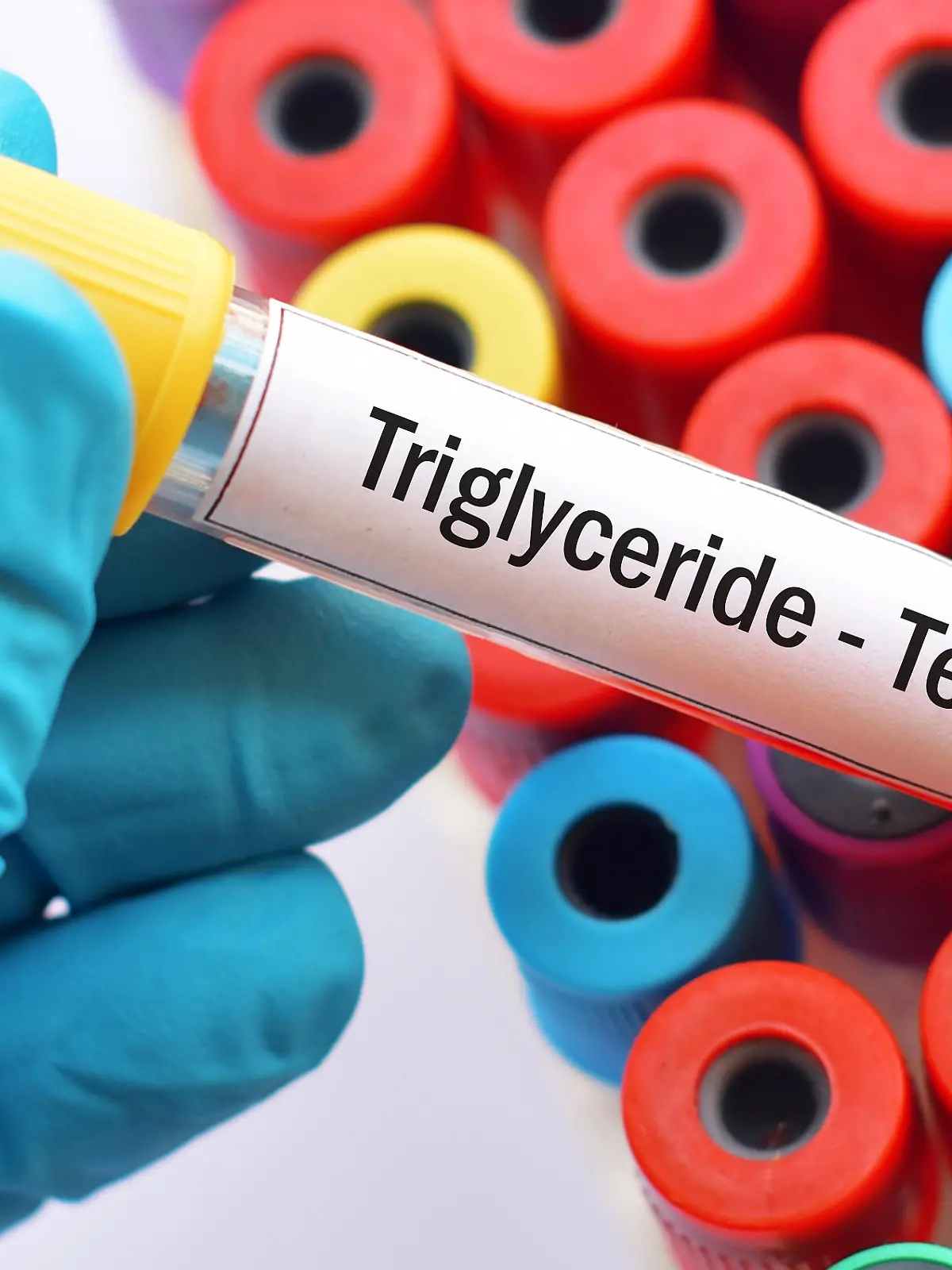 Gesundheitslexikon: Triglyceride