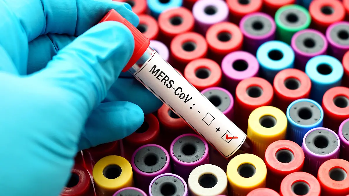 Gesundheitslexikon: MERS