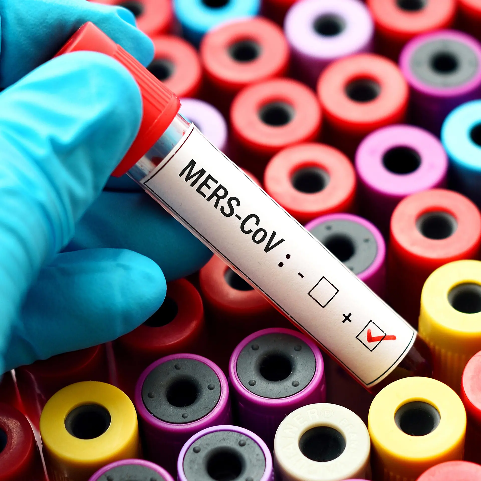 MERS (Middle-East-Respiratory-Syndrom) Logo von MERS (Middle-East-Respiratory-Syndrom)