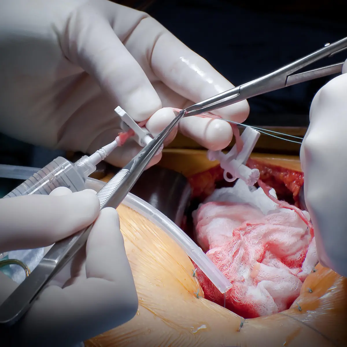 Bypass Logo von Bypass