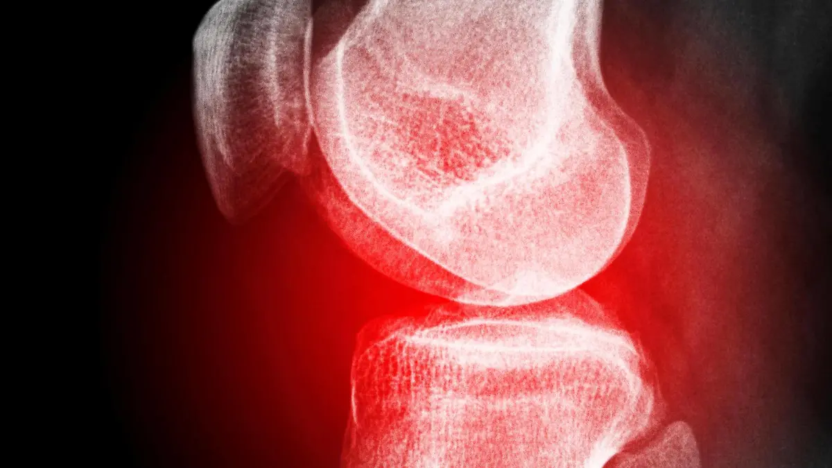 painful knee property released PUBLICATIONxINxGERxSUIxAUTxONLY Copyright: xthomasheckerx Panthermedia07249299
