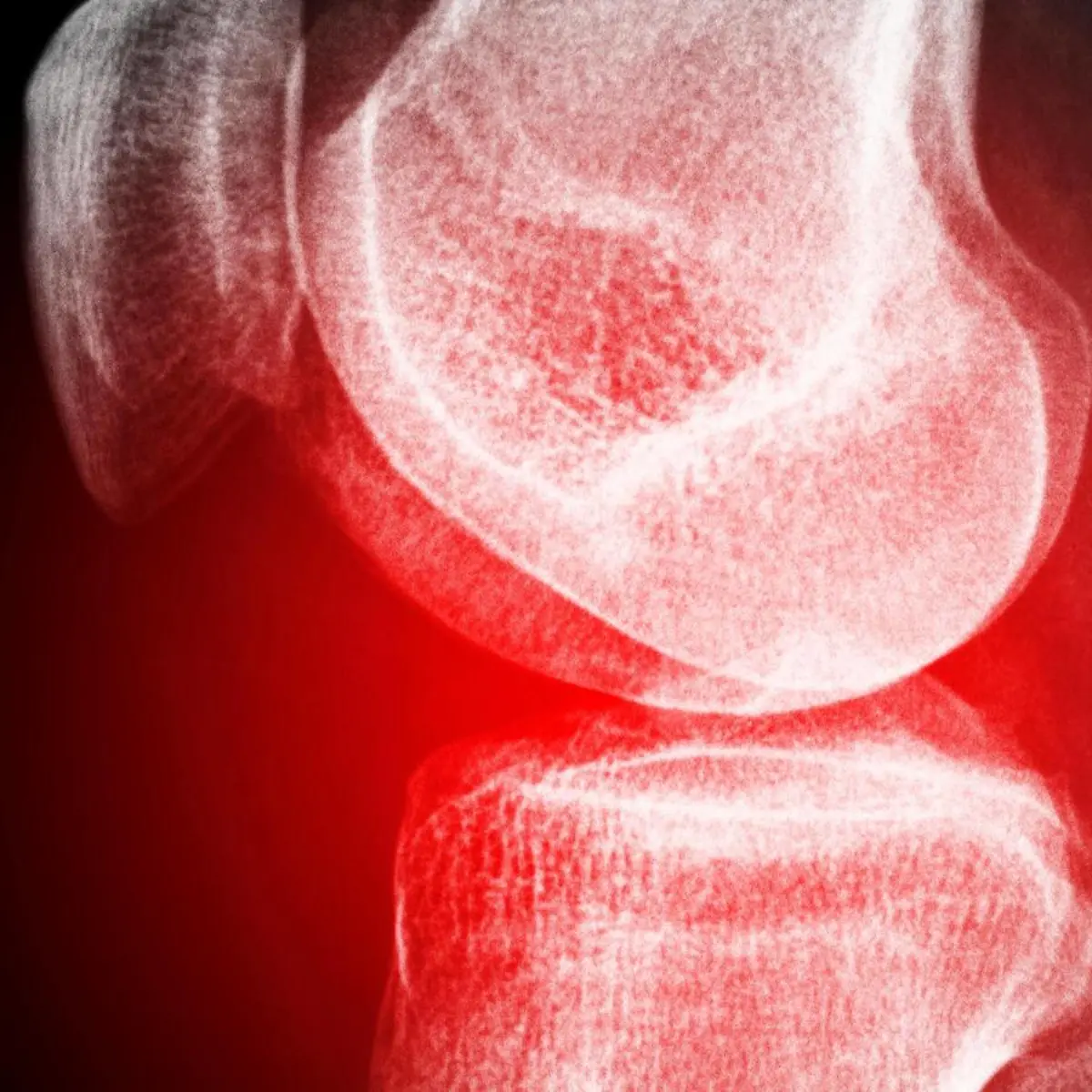 Kniegelenk Logo von Kniegelenk