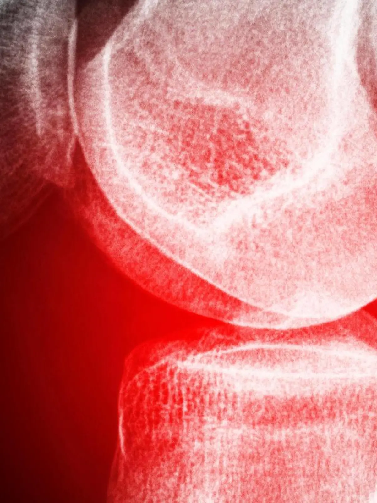 painful knee property released PUBLICATIONxINxGERxSUIxAUTxONLY Copyright: xthomasheckerx Panthermedia07249299  