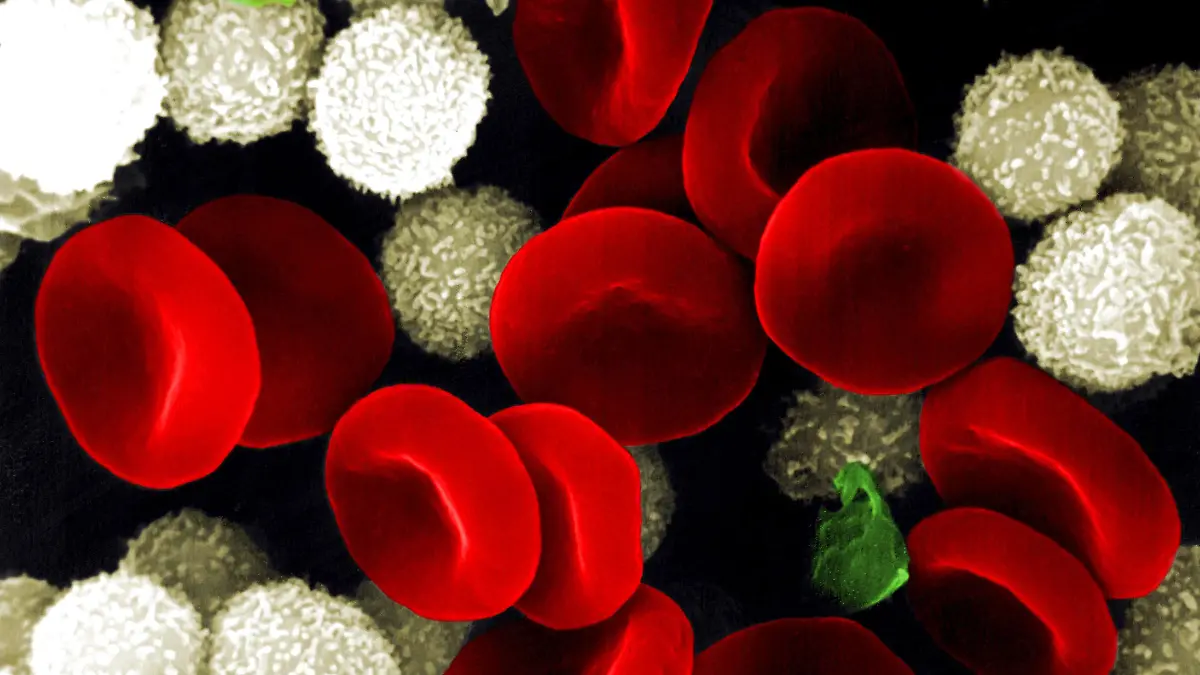 Medizin Histologie
Kreislaufsystem Blutzellen rot: rote Blutkörperchen Erythrozyten und weiß: Lymphozyten und grün: Thrombozyten Mikroaufnahme Rasterelektronenmikroskop coloriert SEM-Aufnahme medicine histology blood cells red erythrocytes and white lymphocytes and green platelets color enhanced scanning electron micrograph SEM blood cells Color enhanced scanning electron micrograph SEM of human blood cells Three components of blood are seen erythrocytes red lymphocytes white and platelets blue Erythrocytes or red blood cells are carriers of oxygen and carbon dioxide Their biconcave shape provides maximum surface area for the exchange of gases Lymphocytes or white blood cells play a central role in immune defence mechanisms fighting pathogens in the blood and lymph system While platelets are not true cells but membrane bound cell fragments of the bone marrow which help the blood clot Platelets may take on many shapes and sizes AF080A sem biology erythrocytes platelet cells platelets micrographs red blood cells micrograph micrography platelet cell white blood cells white blood cell scanning electron micrograph leukocyte blood cells erythrocyte blood cell hematology platelet thrombocyte thrombocytes red blood cell science scanning electron micrographs vascular system