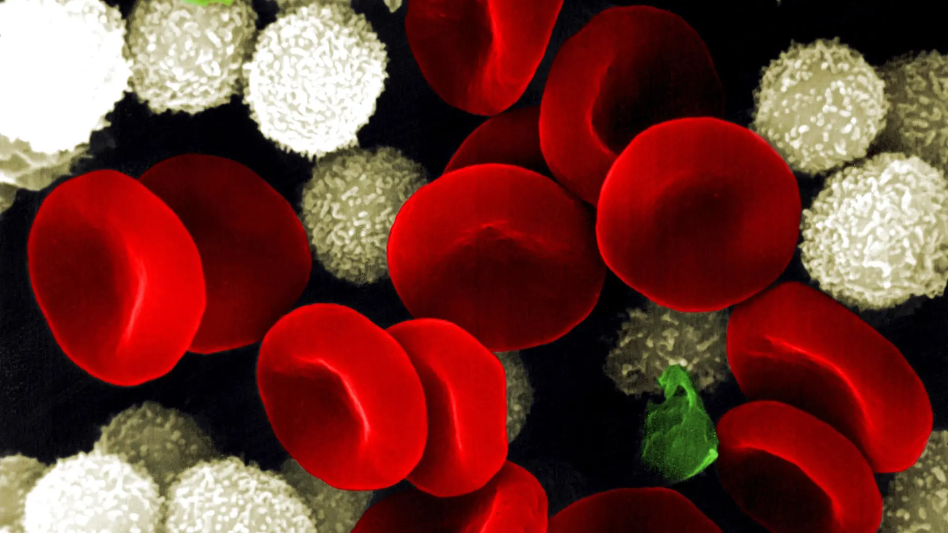 Medizin Histologie
Kreislaufsystem Blutzellen rot: rote Blutkörperchen Erythrozyten und weiß: Lymphozyten und grün: Thrombozyten Mikroaufnahme Rasterelektronenmikroskop coloriert SEM-Aufnahme medicine histology blood cells red erythrocytes and white lymphocytes and green platelets color enhanced scanning electron micrograph SEM blood cells Color enhanced scanning electron micrograph SEM of human blood cells Three components of blood are seen erythrocytes red lymphocytes white and platelets blue Erythrocytes or red blood cells are carriers of oxygen and carbon dioxide Their biconcave shape provides maximum surface area for the exchange of gases Lymphocytes or white blood cells play a central role in immune defence mechanisms fighting pathogens in the blood and lymph system While platelets are not true cells but membrane bound cell fragments of the bone marrow which help the blood clot Platelets may take on many shapes and sizes AF080A sem biology erythrocytes platelet cells platelets micrographs red blood cells micrograph micrography platelet cell white blood cells white blood cell scanning electron micrograph leukocyte blood cells erythrocyte blood cell hematology platelet thrombocyte thrombocytes red blood cell science scanning electron micrographs vascular system