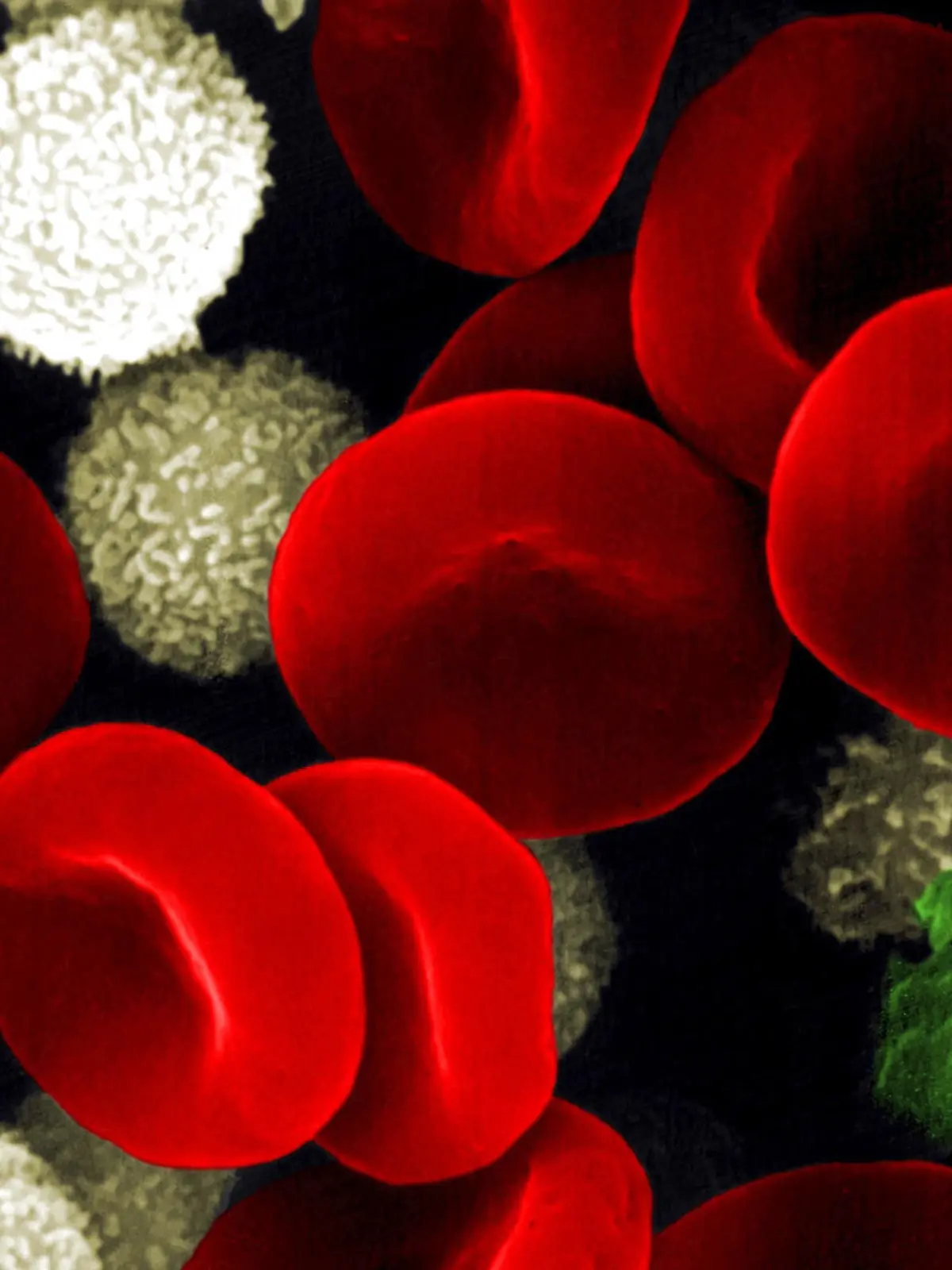 Medizin Histologie

Kreislaufsystem Blutzellen rot: rote Blutkörperchen Erythrozyten und weiß: Lymphozyten und grün: Thrombozyten Mikroaufnahme Rasterelektronenmikroskop coloriert SEM-Aufnahme medicine histology blood cells red erythrocytes and white lymphocytes and green platelets color enhanced scanning electron micrograph SEM blood cells Color enhanced scanning electron micrograph SEM of human blood cells Three components of blood are seen erythrocytes red lymphocytes white and platelets blue Erythrocytes or red blood cells are carriers of oxygen and carbon dioxide Their biconcave shape provides maximum surface area for the exchange of gases Lymphocytes or white blood cells play a central role in immune defence mechanisms fighting pathogens in the blood and lymph system While platelets are not true cells but membrane bound cell fragments of the bone marrow which help the blood clot Platelets may take on many shapes and sizes AF080A sem biology erythrocytes platelet cells platelets micrographs red blood cells micrograph micrography platelet cell white blood cells white blood cell scanning electron micrograph leukocyte blood cells erythrocyte blood cell hematology platelet thrombocyte thrombocytes red blood cell science scanning electron micrographs vascular system