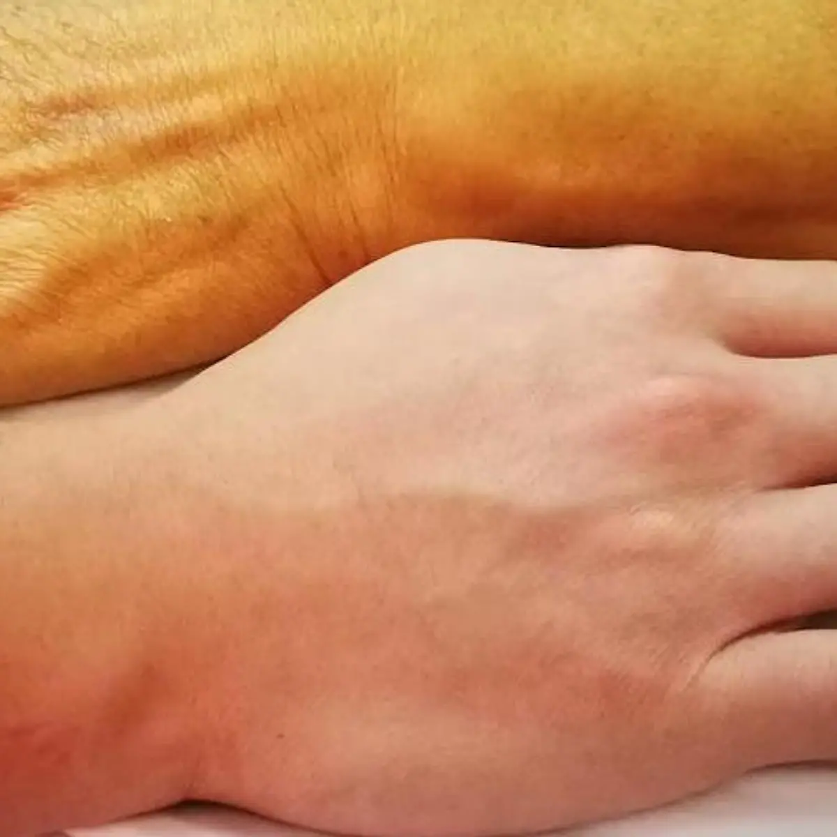 Gelbsucht (Ikterus) Logo von Gelbsucht (Ikterus)