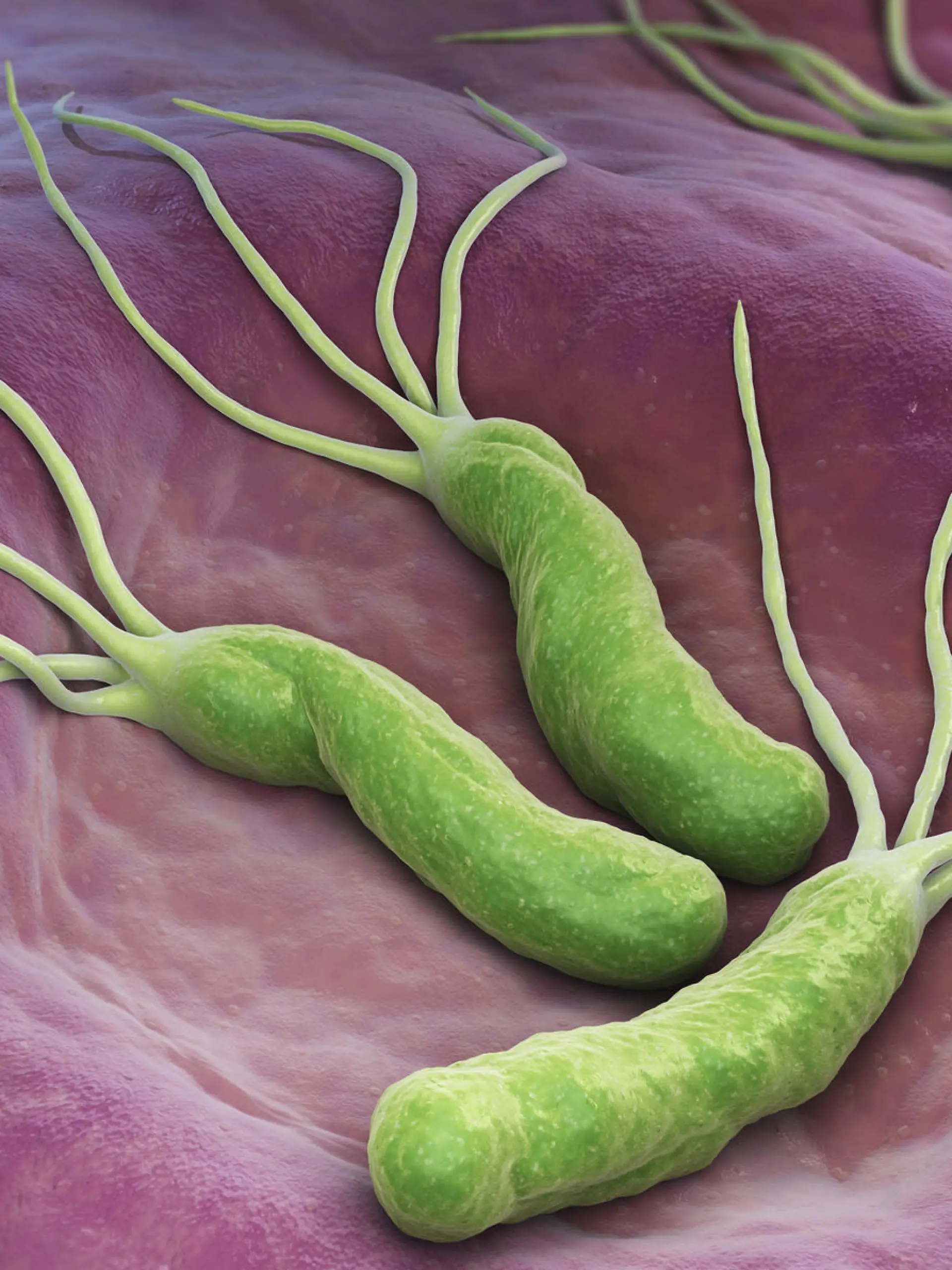Gesundheitslexikon: Helicobacter pylori