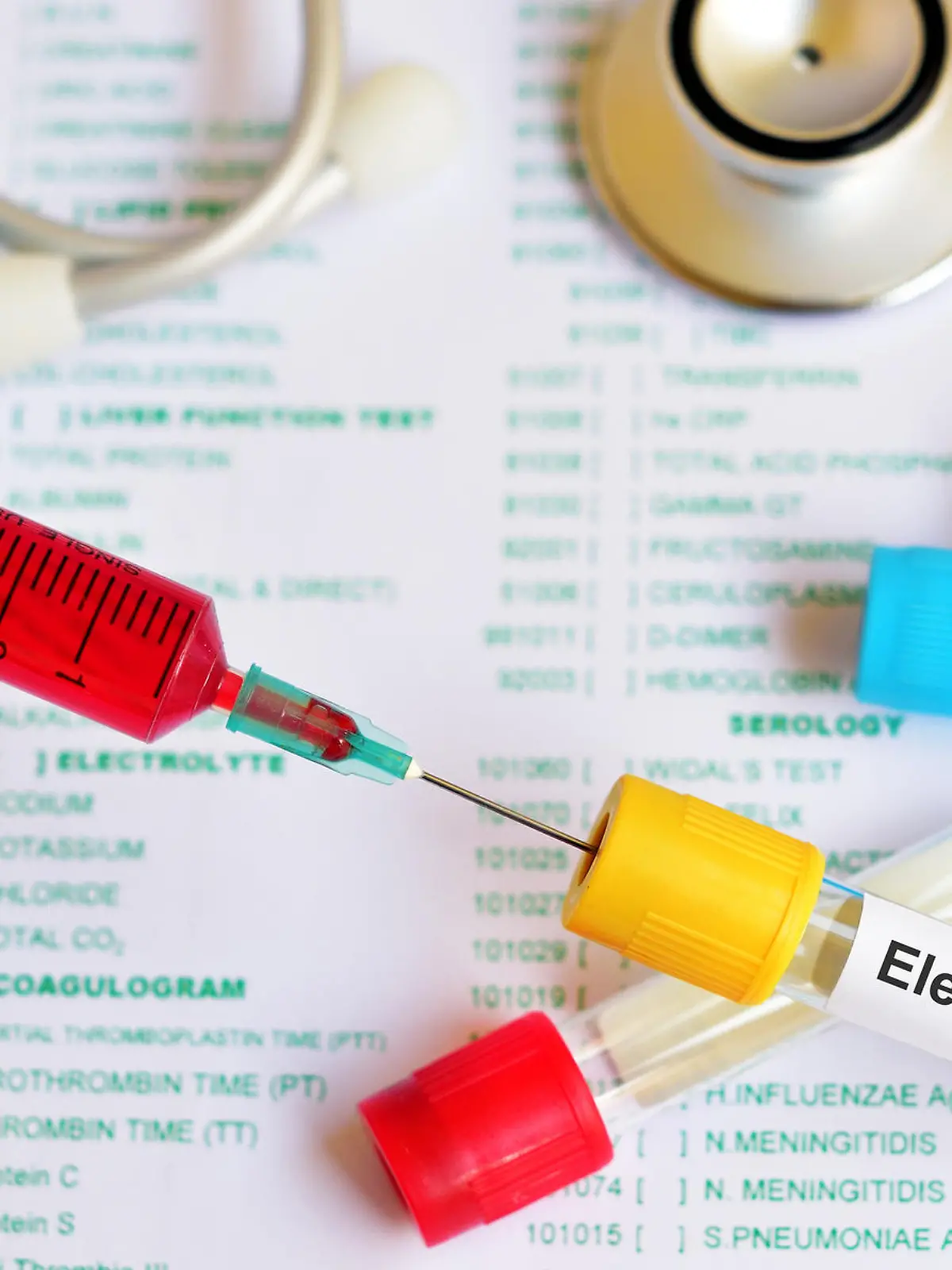 Gesundheitslexikon: Elektrolyte sind lebensnotwendig für uns