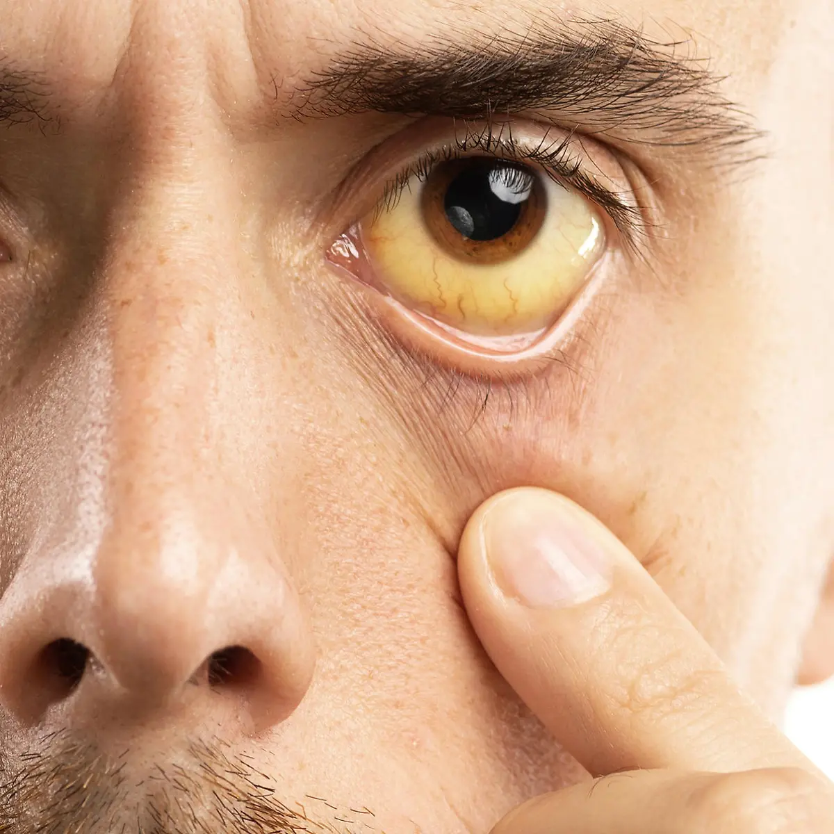 Bilirubin Logo von Bilirubin