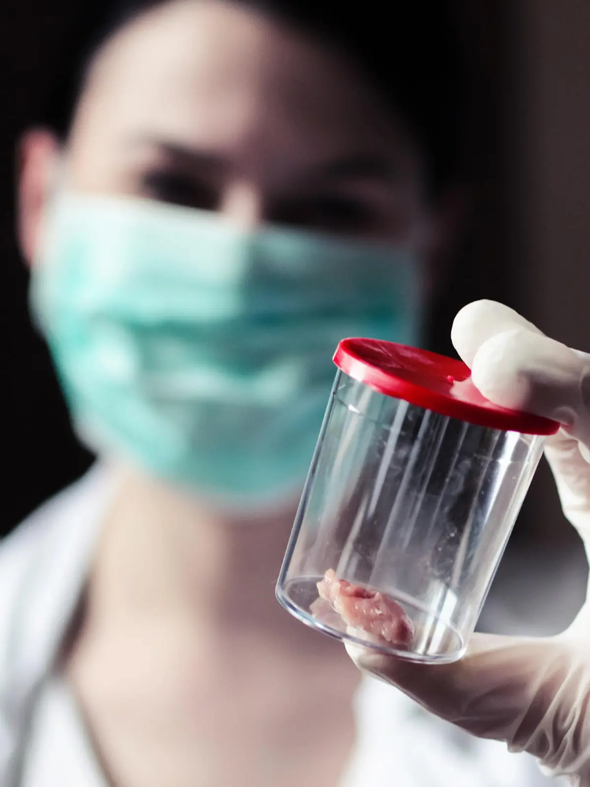 Gesundheitslexikon: Mit einer Biopsie gewinnt der Arzt eine Gewebeprobe vom Patienten.