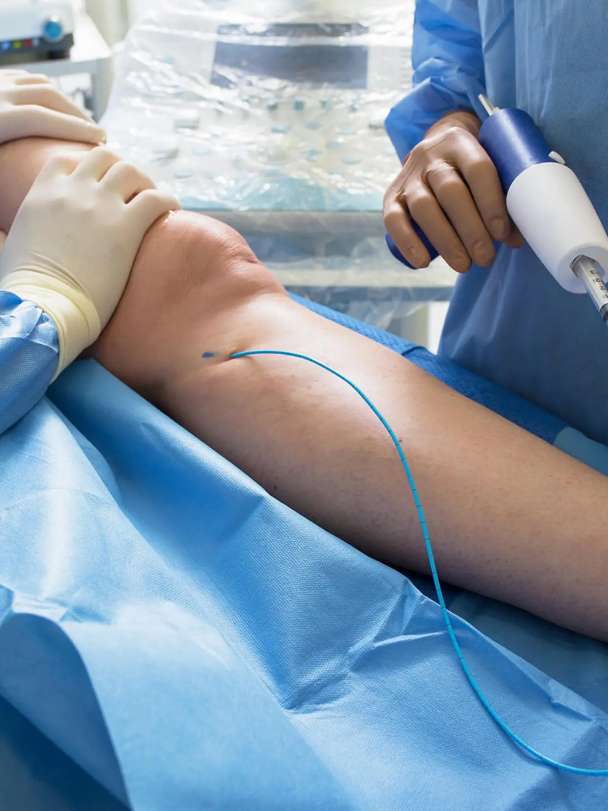 Gesundheitslexikon: Die Gefäßchirurgie beschäftigt sich mit Störungen und Erkrankungen der Blutgefäße
