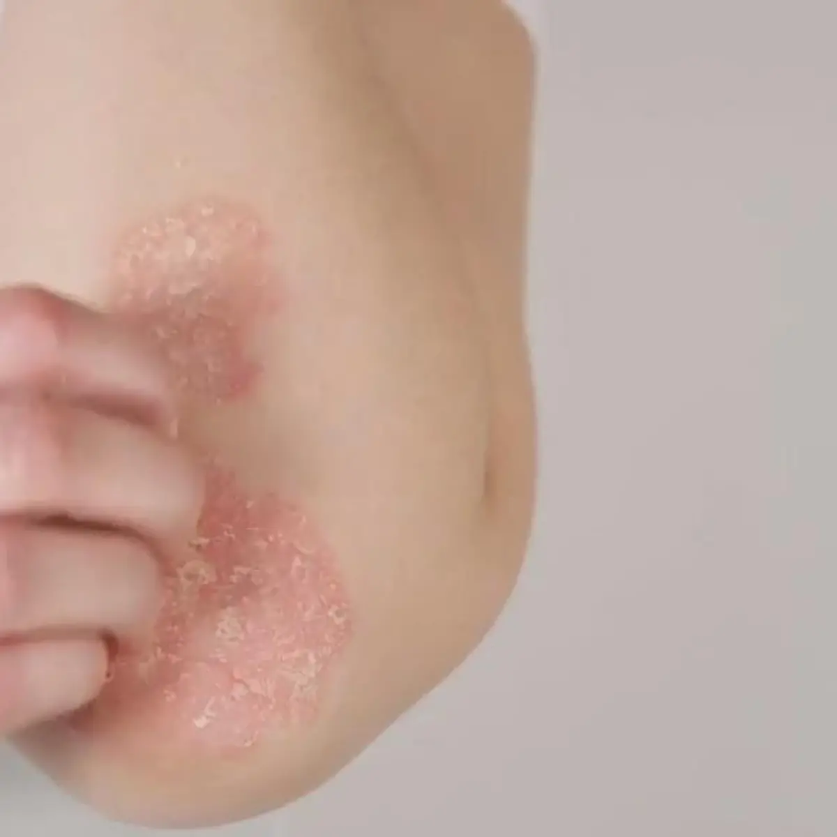 Hautkrankheiten Logo von Hautkrankheiten