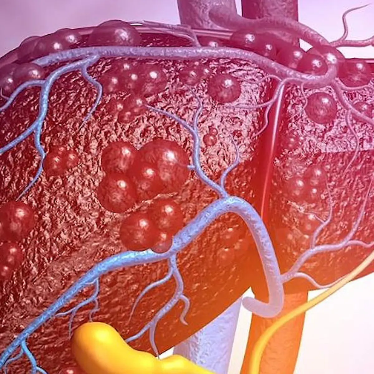 Morbus Meulengracht (Gilbert-Syndrom) Logo von Morbus Meulengracht (Gilbert-Syndrom)