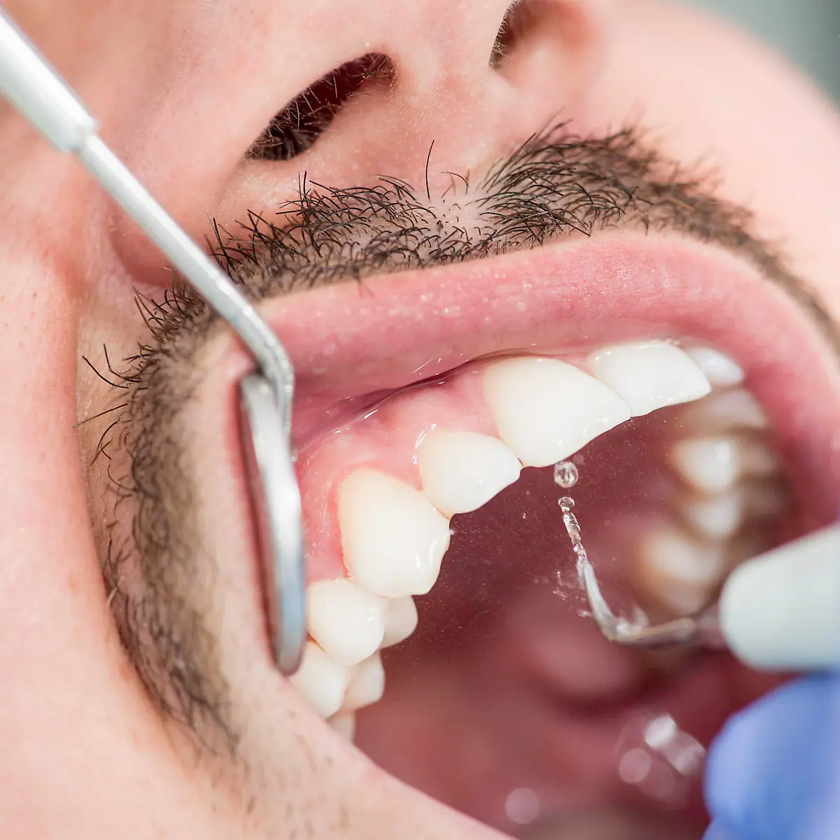 Zahnstein Logo von Zahnstein