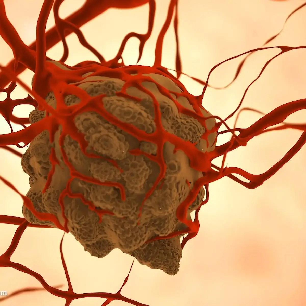 Tumor Logo von Tumor