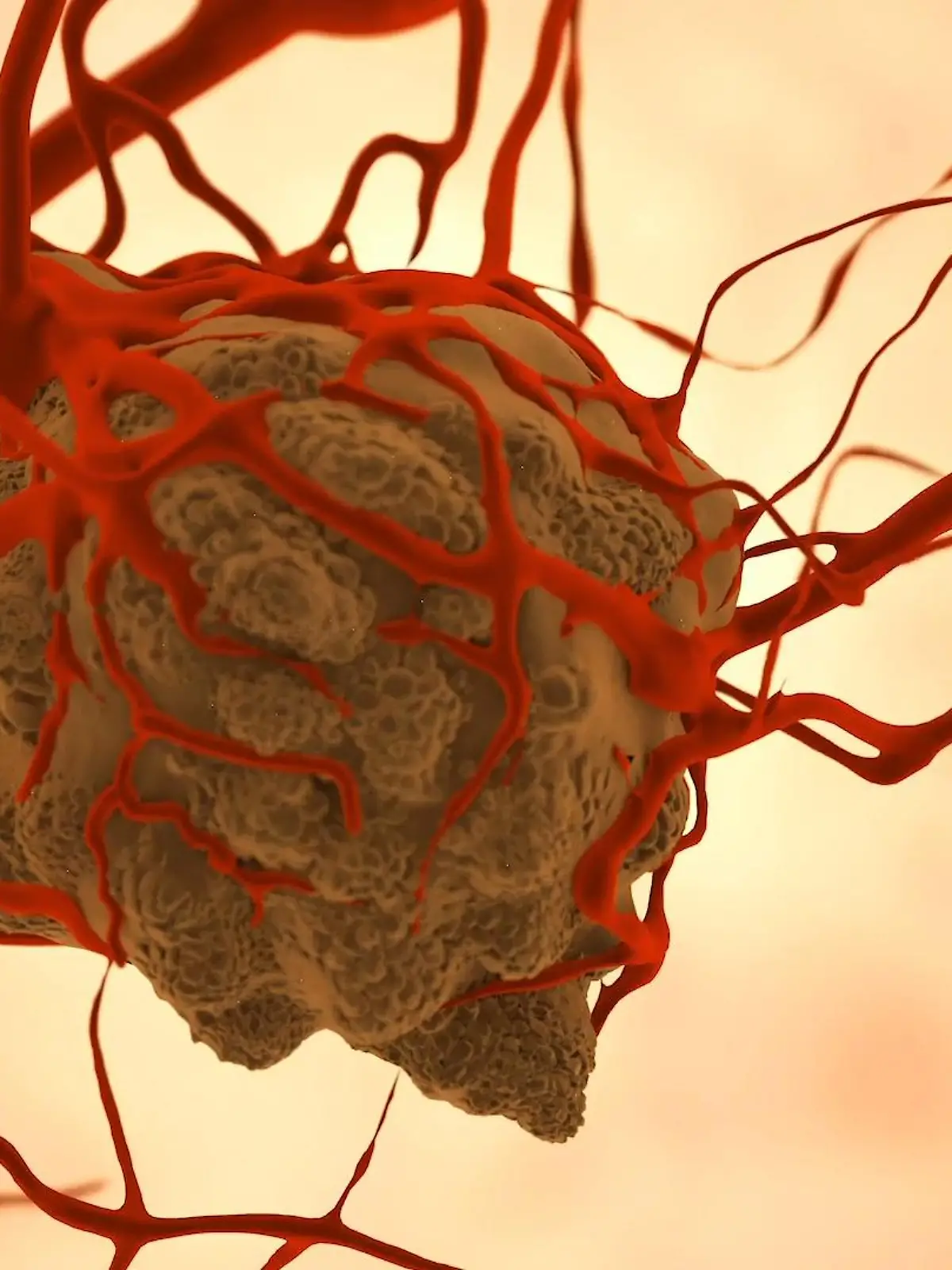 Bild zu: "Tumor"