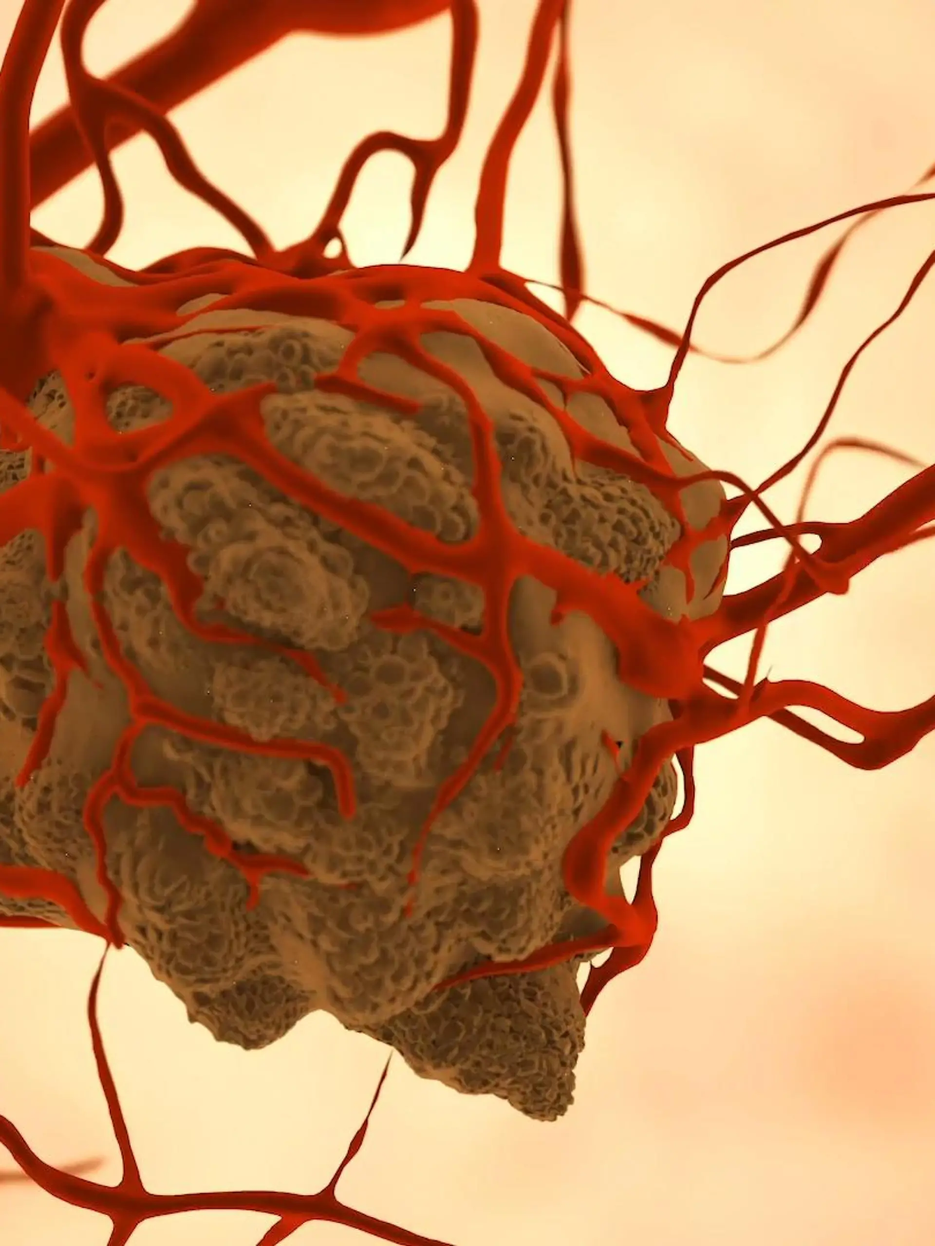 Bild zu: "Tumor"