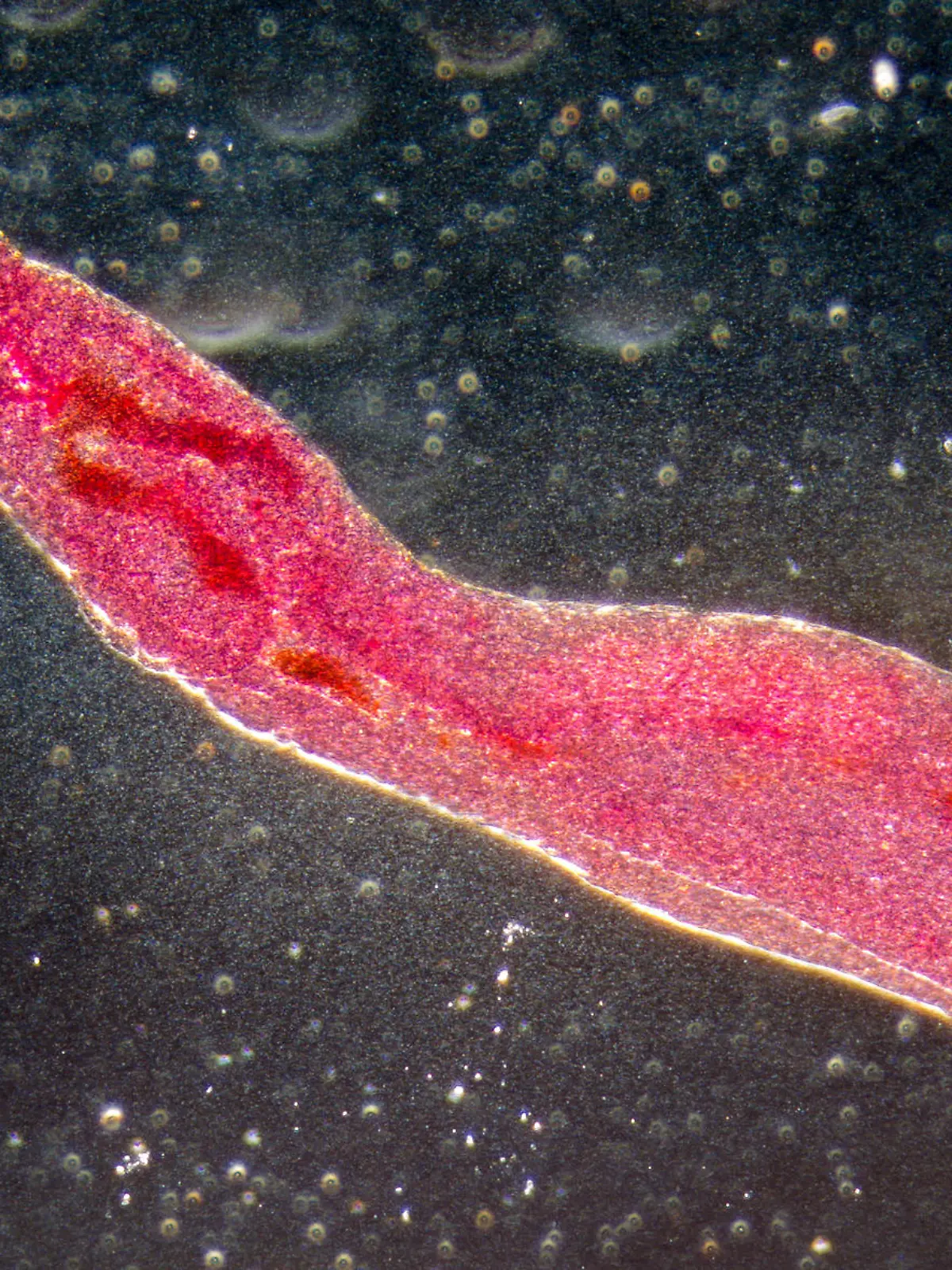 Reisende können sich in tropischen Gewässern mit Bilharziose infizieren. Dabei befallen Parasiten Darm und Harnwege.