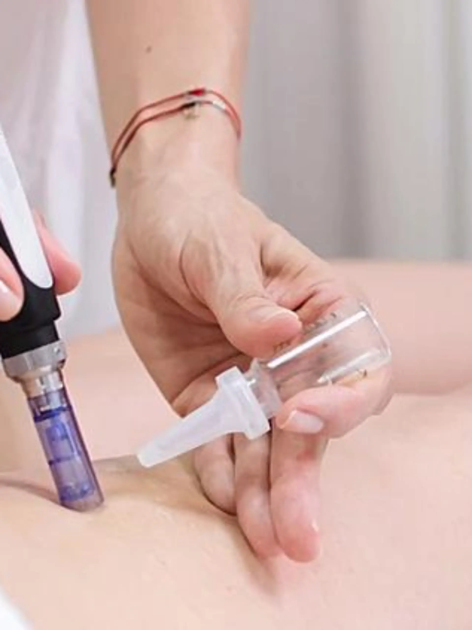 Bild zu: "Mesotherapie"