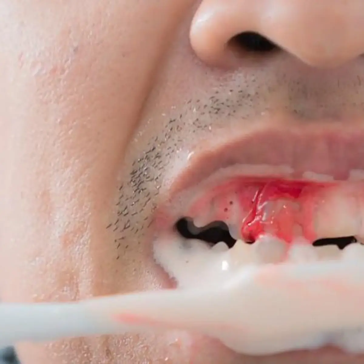 Zahnfleischbluten Logo von Zahnfleischbluten