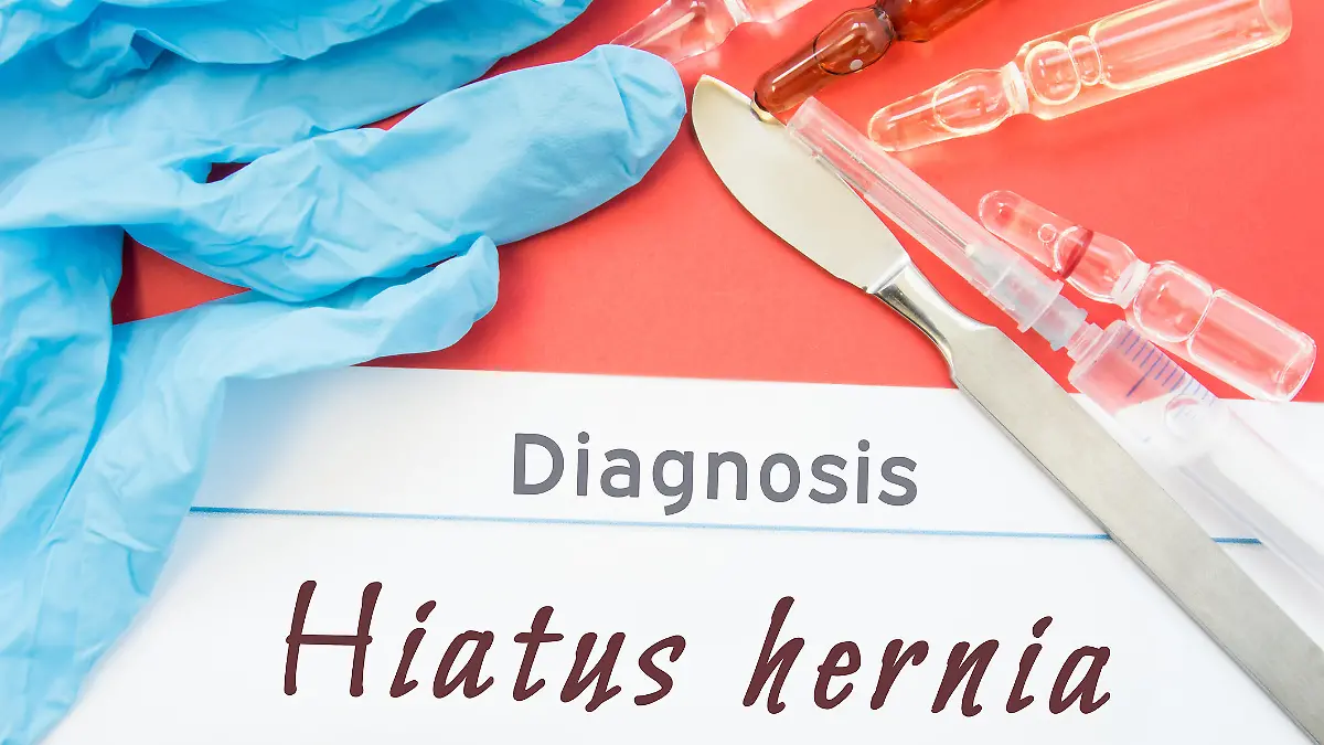 Gesundheitslexikon: Zwerchfellhernie