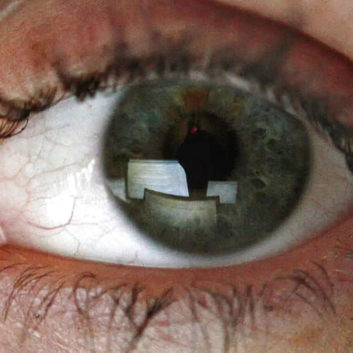 Hypertensive Retinopathie Logo von Hypertensive Retinopathie