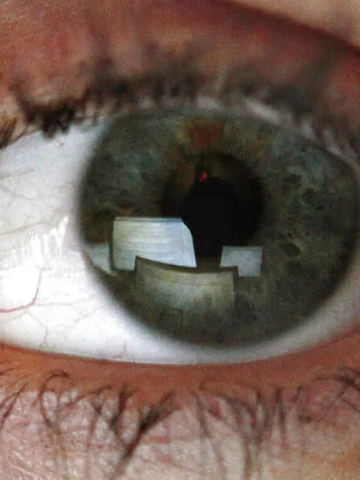 Bild zu: "Hypertensive Retinopathie"
