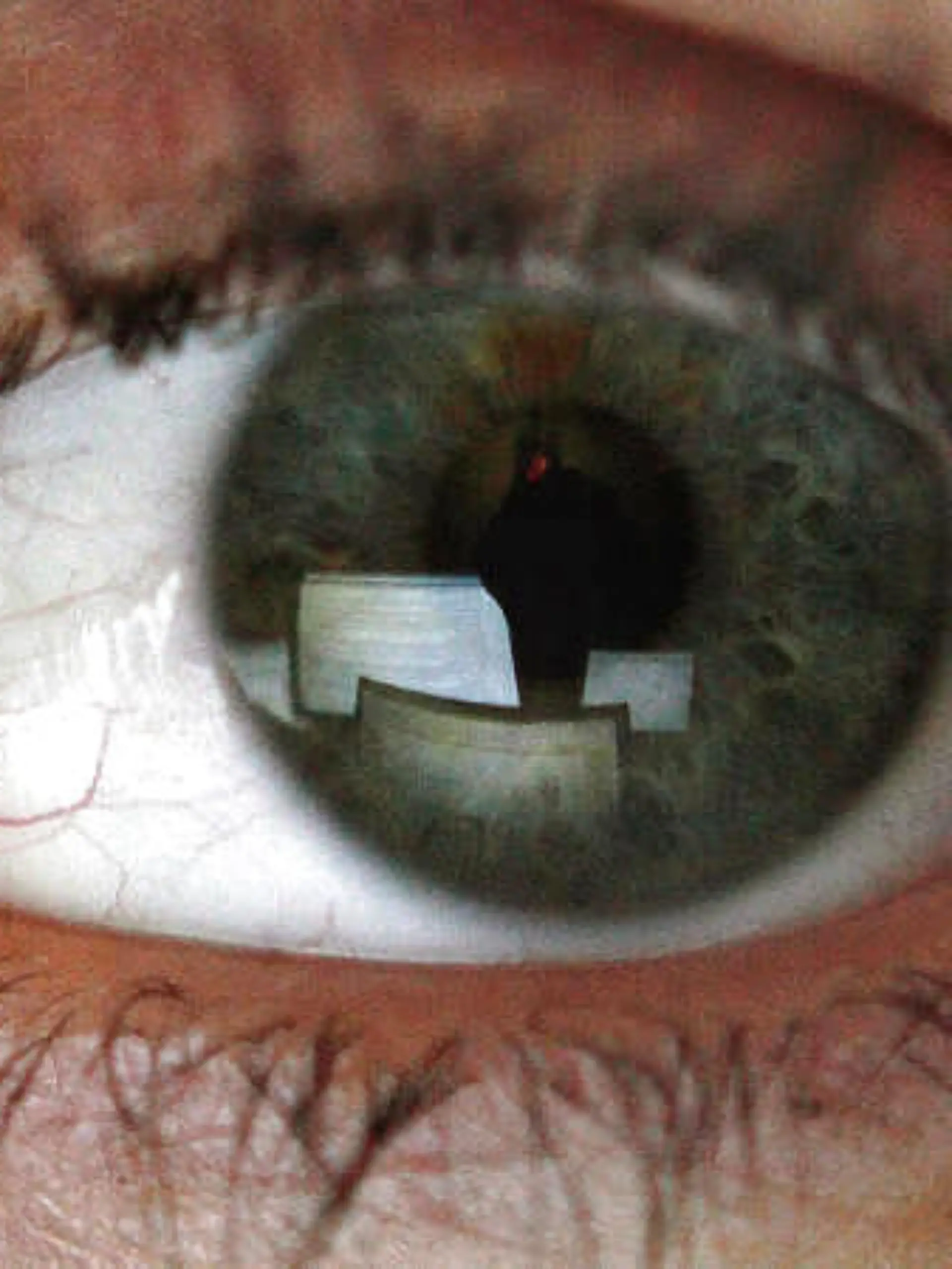 Bild zu: "Hypertensive Retinopathie"