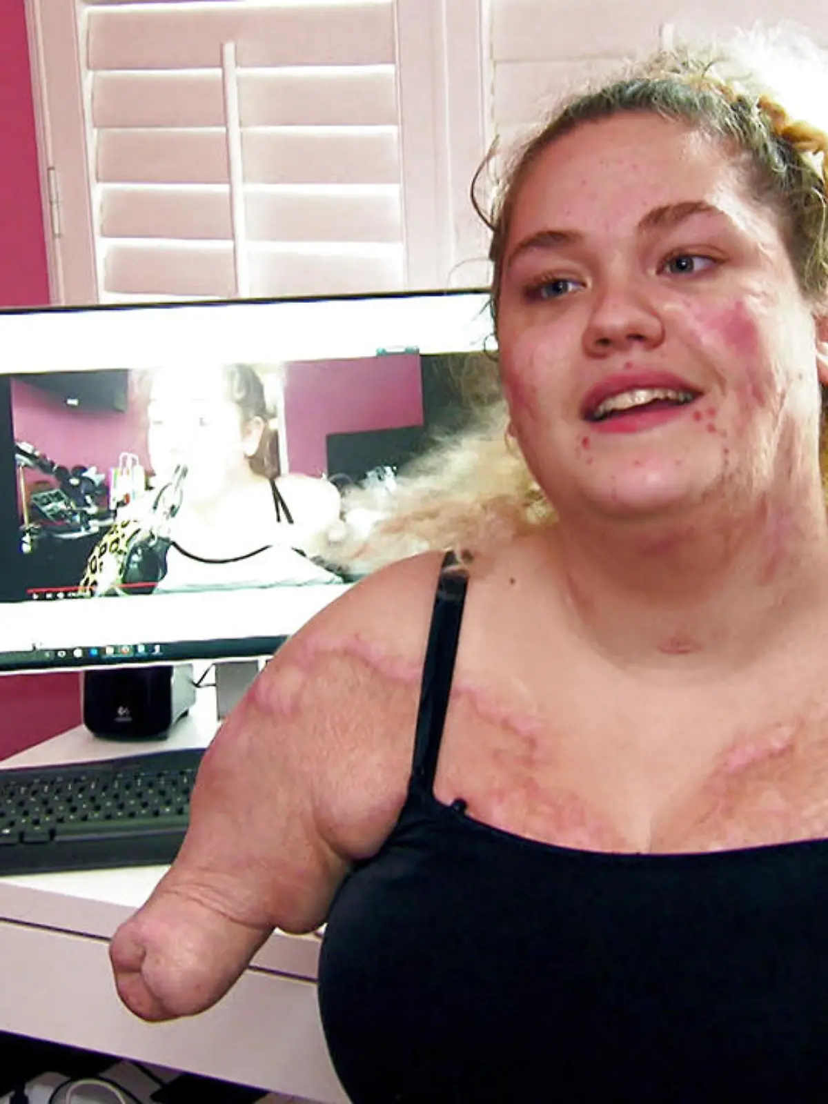 Bild zu: "Meningitis: Kaitlyn gibt nicht auf"