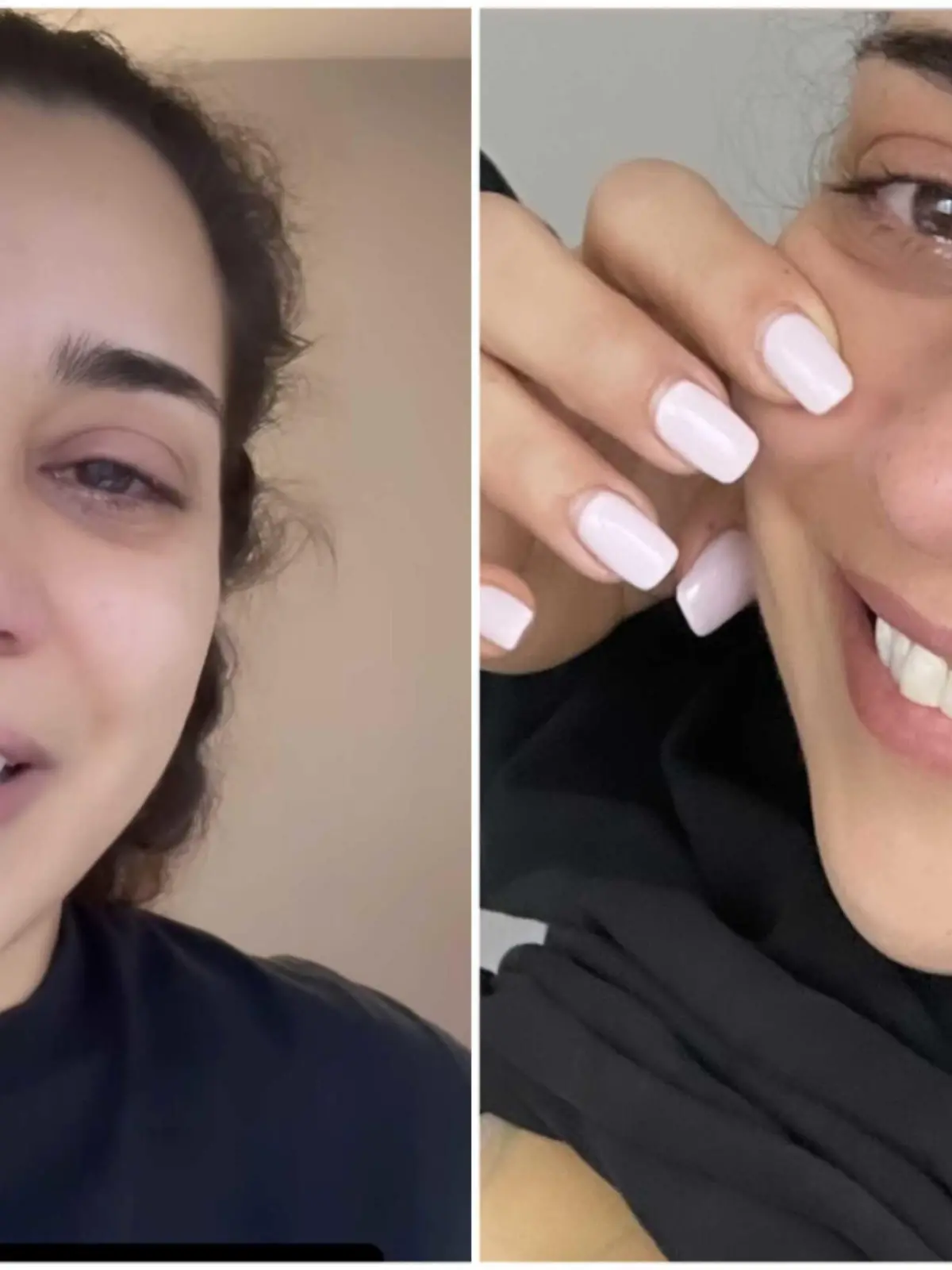 Nadja Benaissa ist froh, dass ihre Silikon-Implantate entfertn wurden