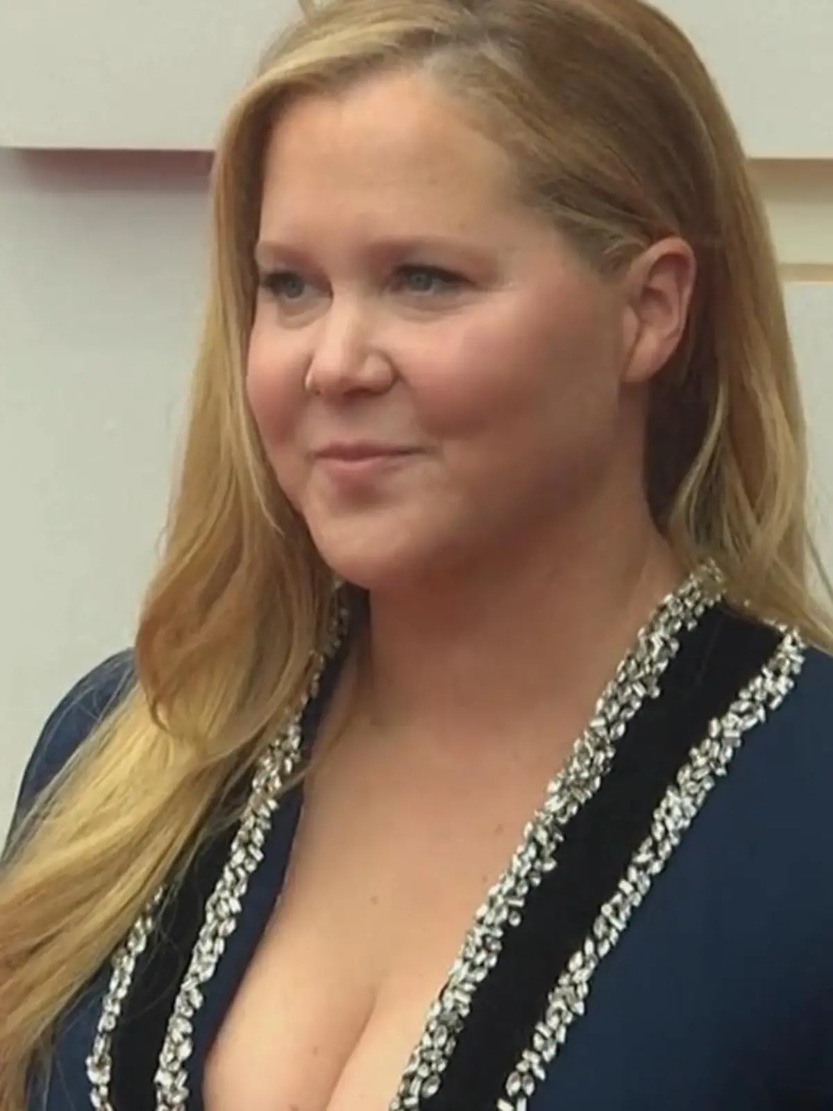 Eigentlich bringt Comedy-Star Amy Schumer ja nichts aus der Ruhe ...

Doch den Spott über ihr aufgedunsenes Gesicht wollte die 42-Jährige nicht auf sich sitzen lassen und verriet, dass sie wegen des Cushing-Syndroms so aussieht. Im Video erklärt ein Arzt, was es damit auf sich hat.