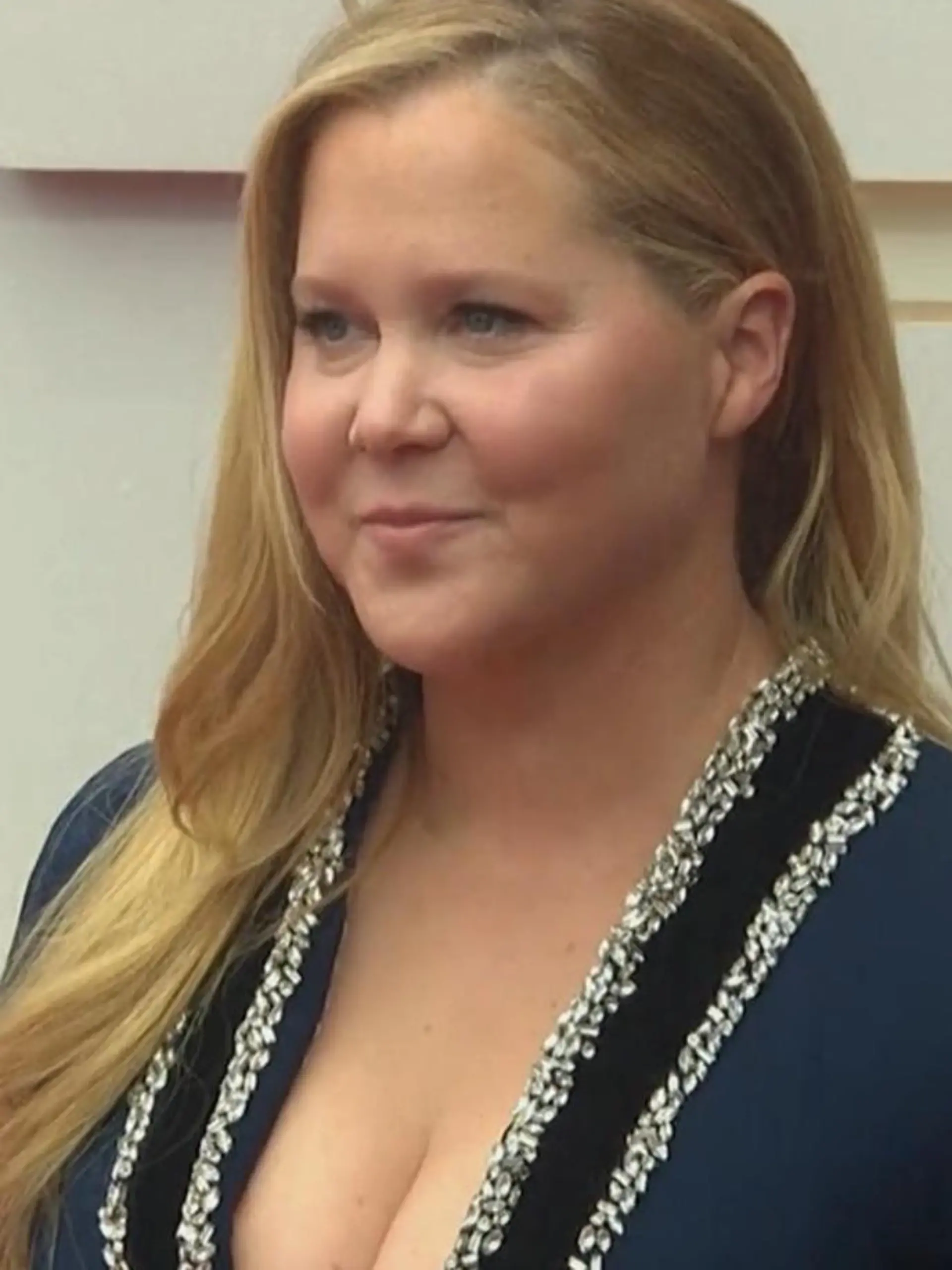 Eigentlich bringt Comedy-Star Amy Schumer ja nichts aus der Ruhe ...

Doch den Spott über ihr aufgedunsenes Gesicht wollte die 42-Jährige nicht auf sich sitzen lassen und verriet, dass sie wegen des Cushing-Syndroms so aussieht. Im Video erklärt ein Arzt, was es damit auf sich hat.