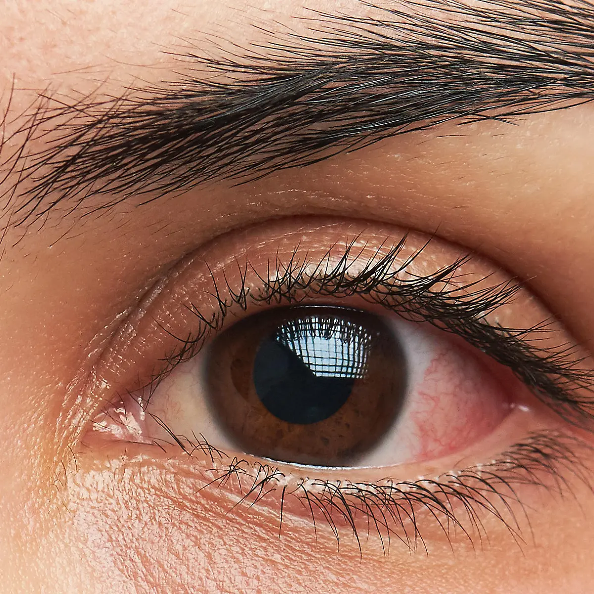 Trockene Augen Logo von Trockene Augen