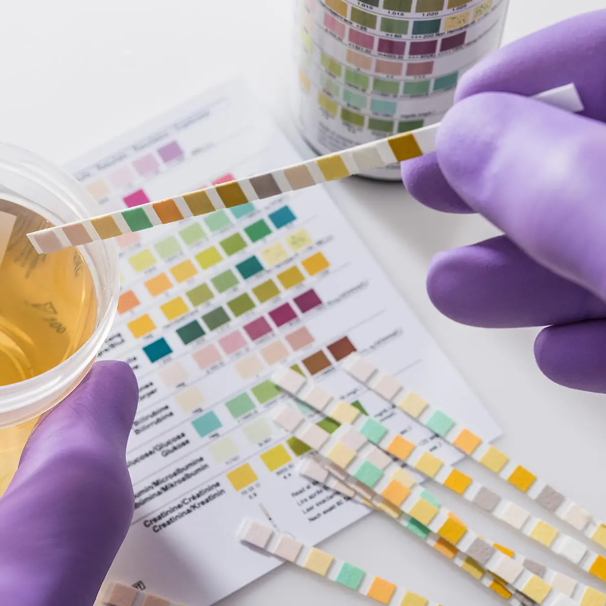 Hämaturie (Blut im Urin) Logo von Hämaturie (Blut im Urin)