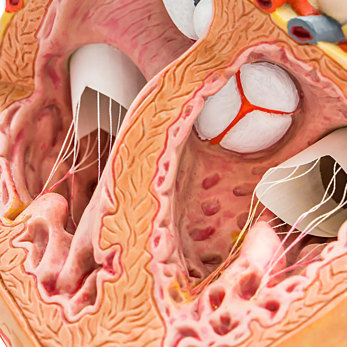 Trikuspidalklappe Logo von Trikuspidalklappe