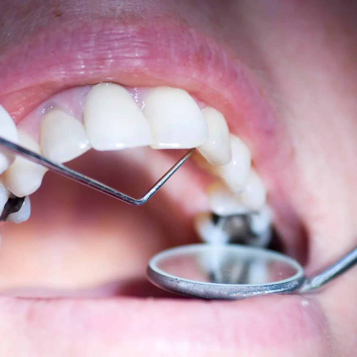 Chlorhexidin Logo von Chlorhexidin