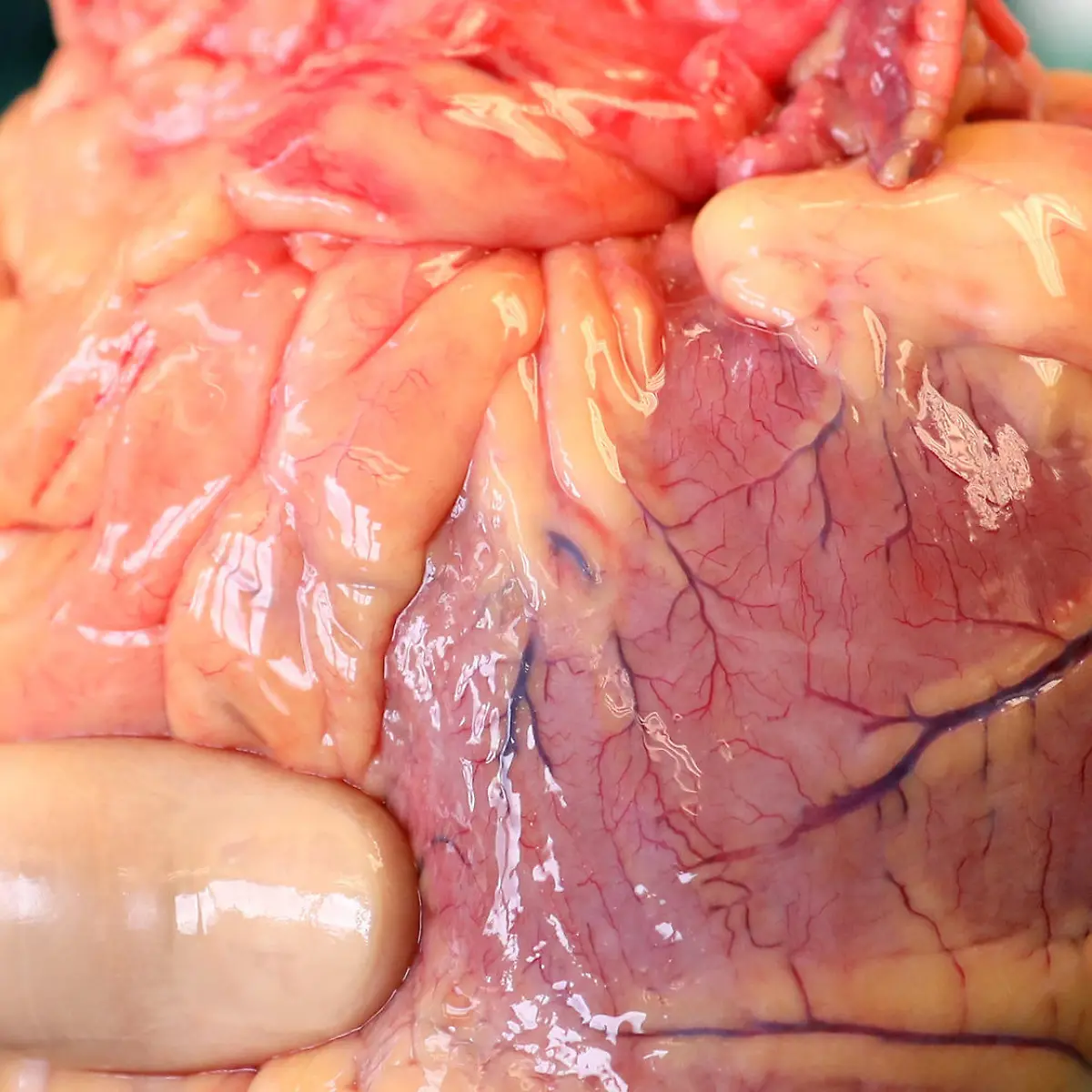 Aortenklappe Logo von Aortenklappe