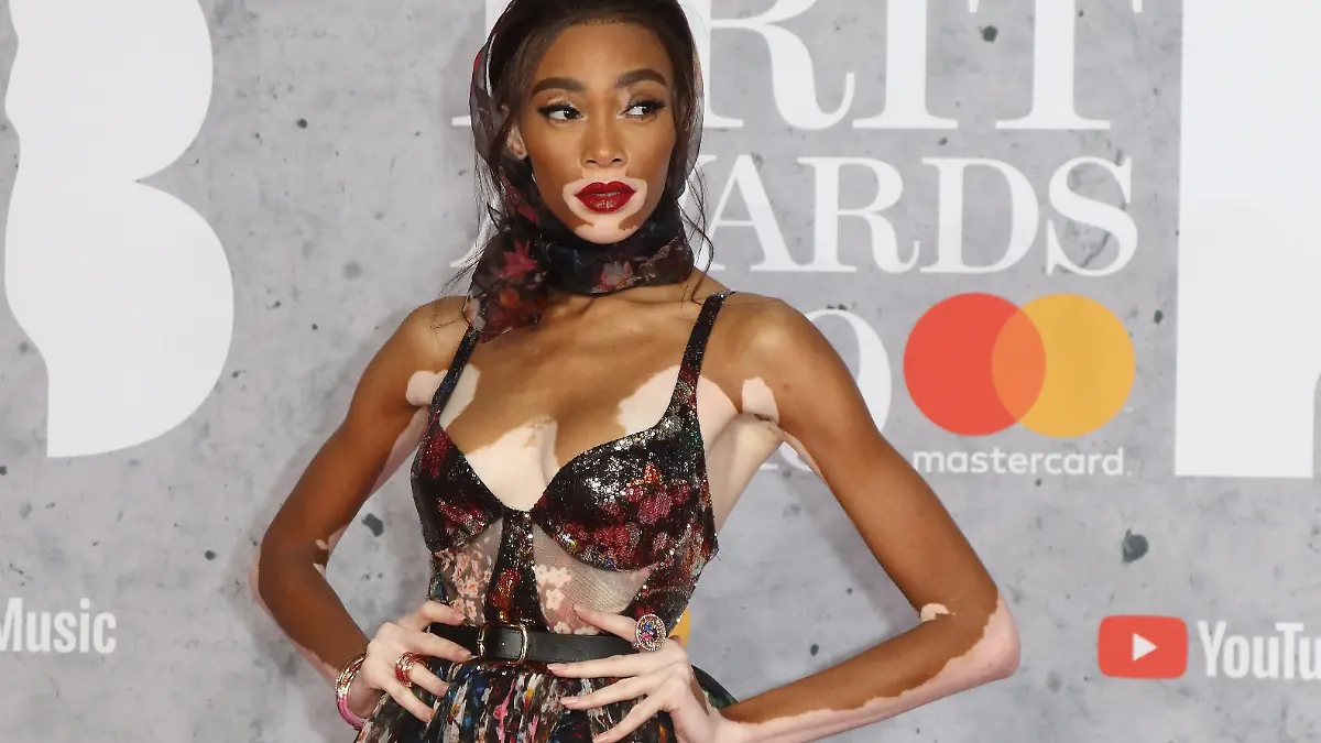 Model Winnie Harlow