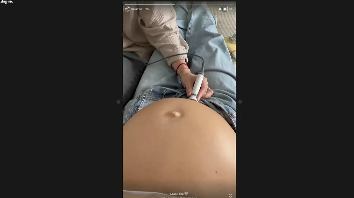 Lena Gercke filmt ihre Ultraschalluntersuchung